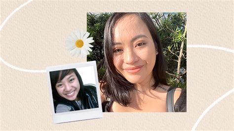 Belo Facial for Teen Acne .